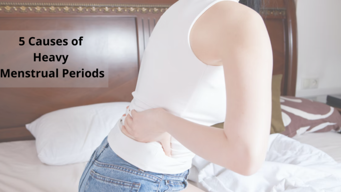 5 Causes of Heavy Menstrual Periods